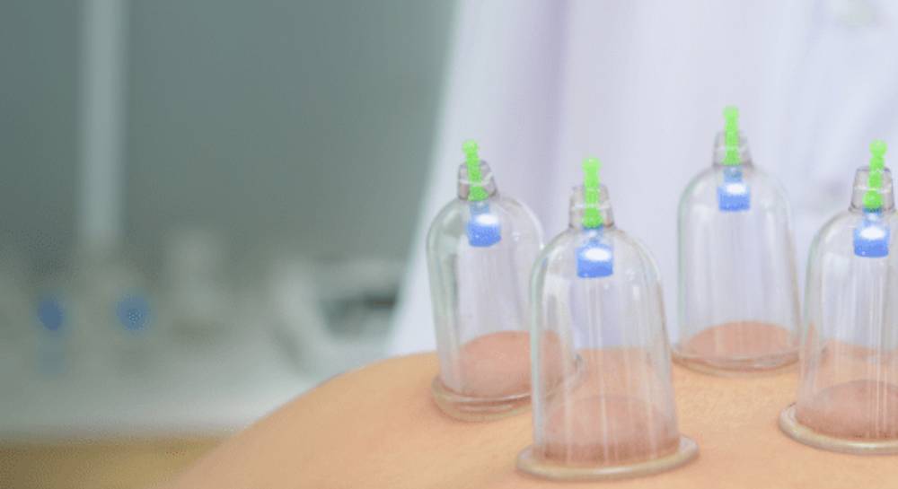 why-should-i-fast-before-having-hijama-wet-cupping-greensoul-cupping