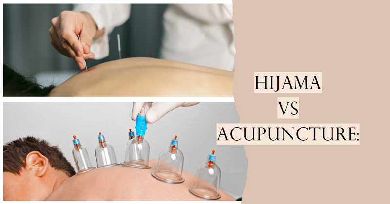 Hijama and Blood Donation: Are They Different? हिजामा और रक्तदान: क्या ये अलग हैं?