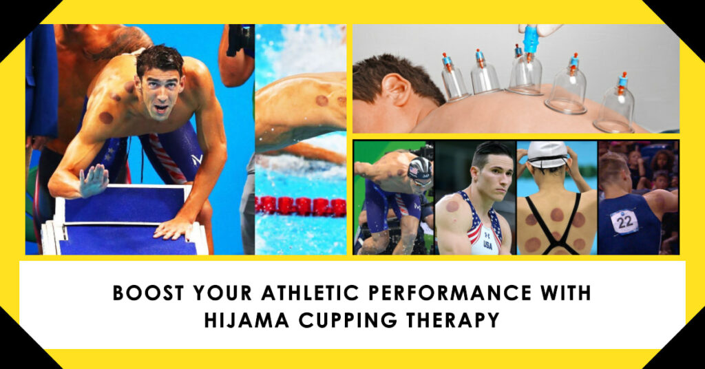 Athletes as superheroes – they push their bodies to the limits with intense workouts, just like how heroes fight battles. Hijama Cupping for Athletes