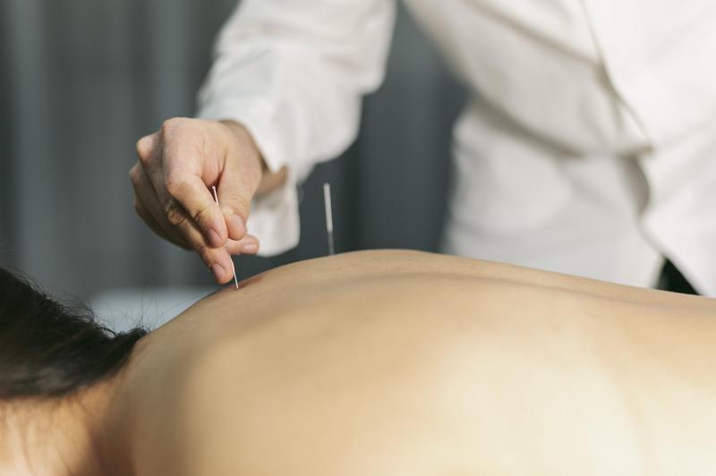 What is Dry Needling? ड्राई नीडलिंग क्या होता है?
