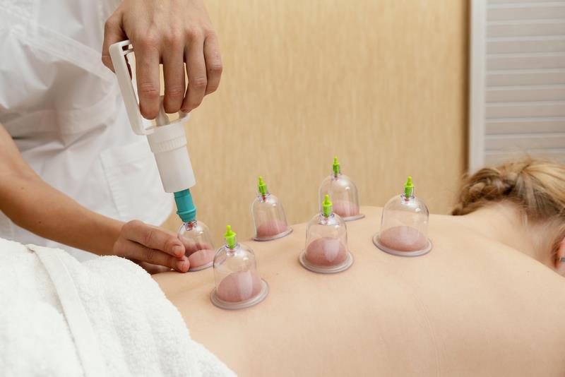 Hijama in Menstrual Cycle